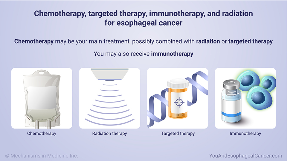Chemotherapy, targeted therapy, immunotherapy, and radiation for esophageal cancer