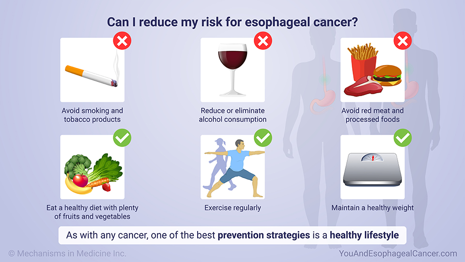 Can I reduce my risk for esophageal cancer?
