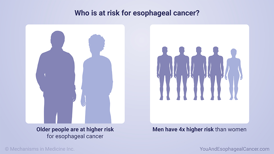 Who is at risk for esophageal cancer?
